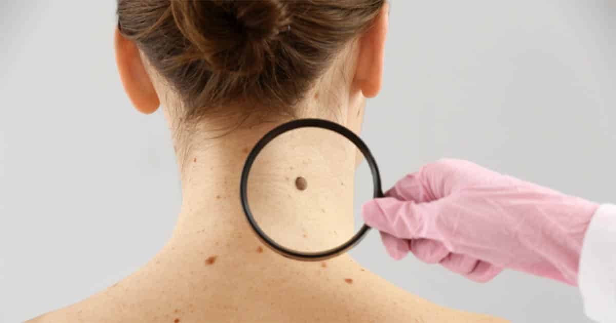 When To Seek Skin Medical Care